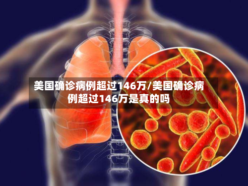 美国确诊病例超过146万/美国确诊病例超过146万是真的吗-第1张图片