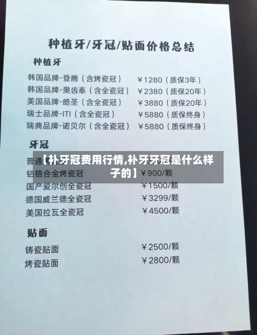 【补牙冠费用行情,补牙牙冠是什么样子的】