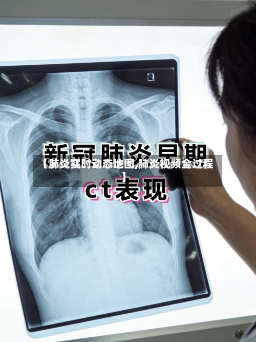 【肺炎实时动态地图,肺炎视频全过程】-第3张图片